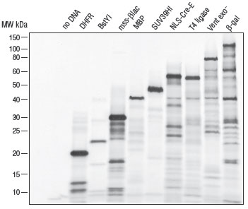 Figure 2: Incorporation of 35S-methionine enables visualizationof protein by autoradiography 