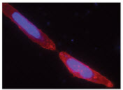 Figure 1: Live U2OS cells transiently transfected with pSNAP-ADRβ2