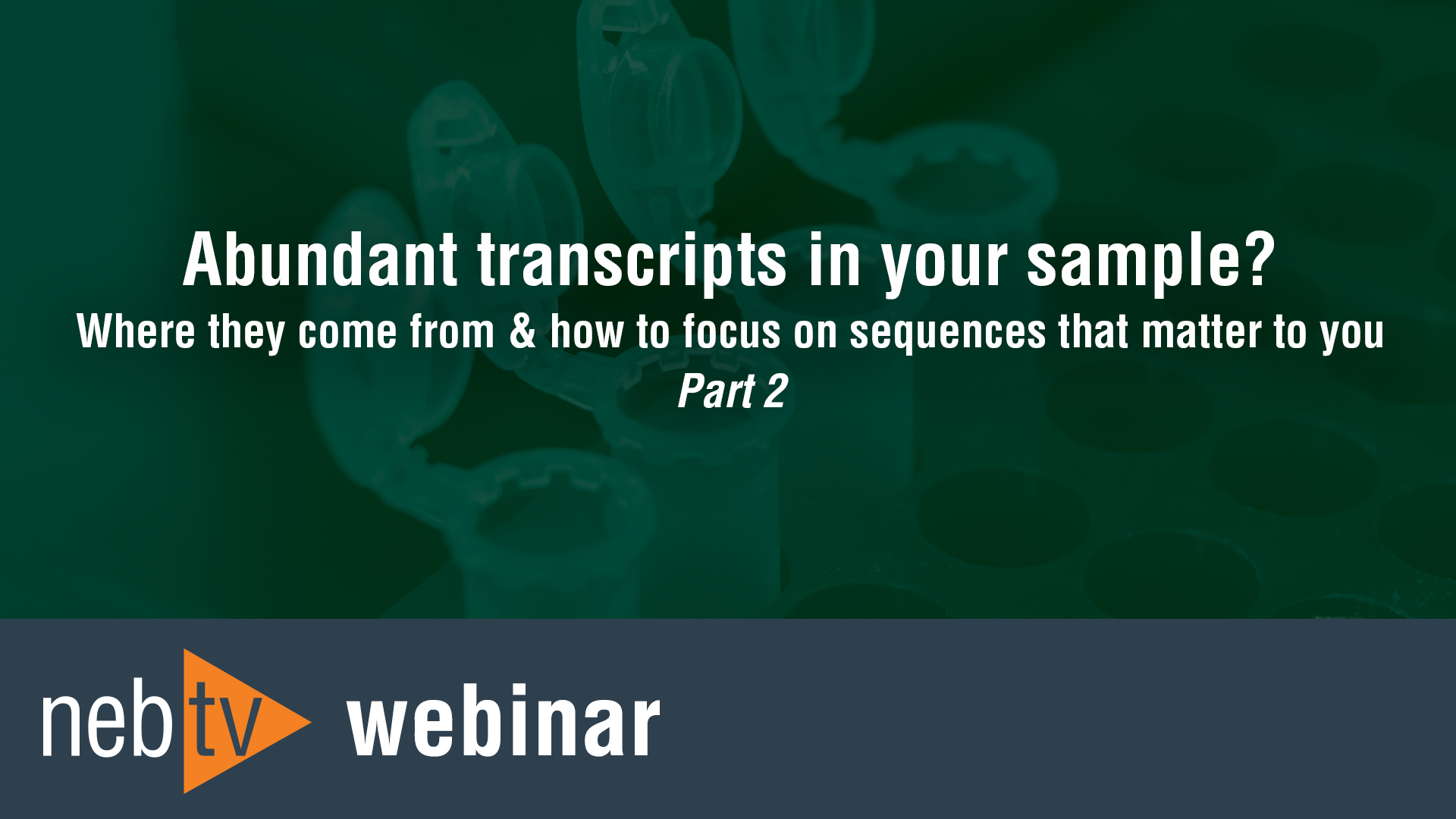 Abundant-transcripts-in-your-sample-Part2
