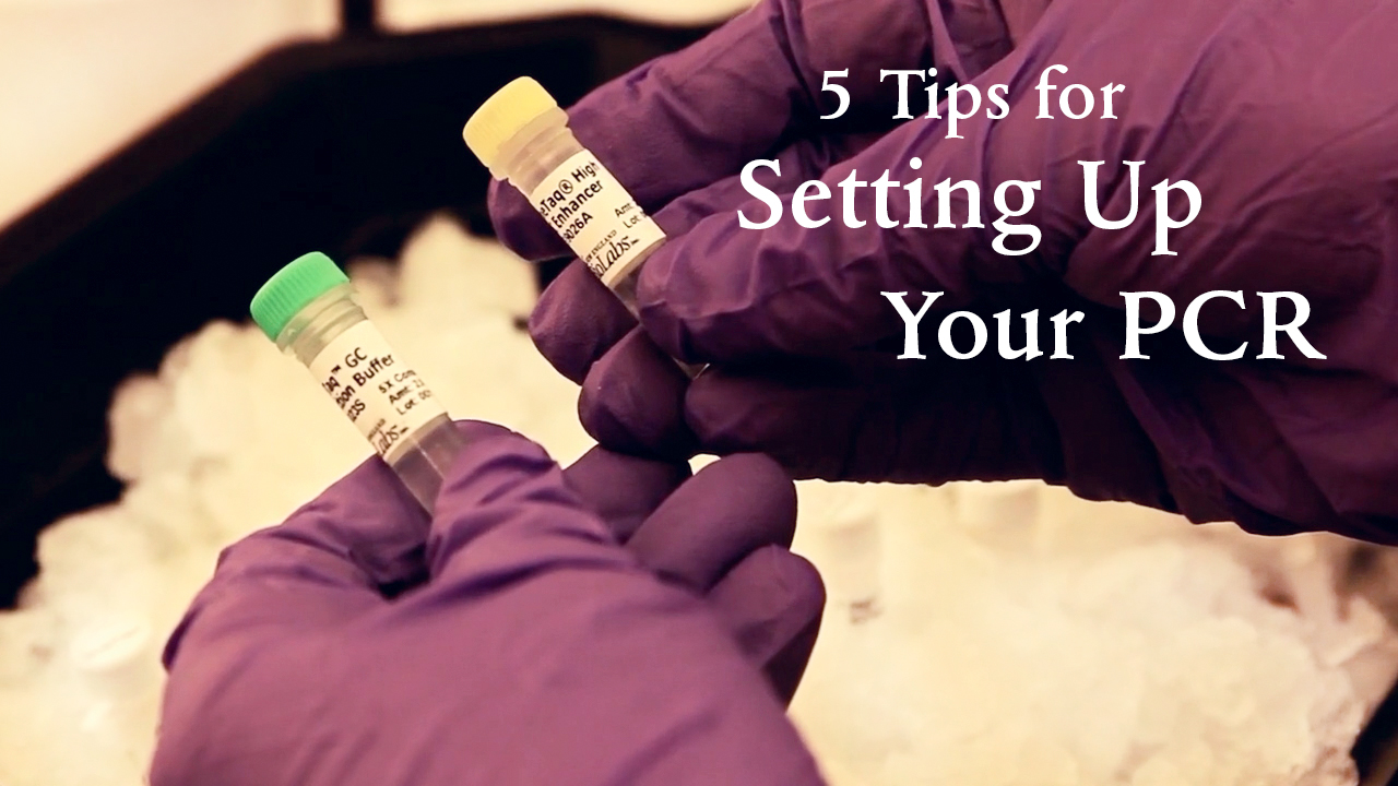 5 tips for setting up your PCR